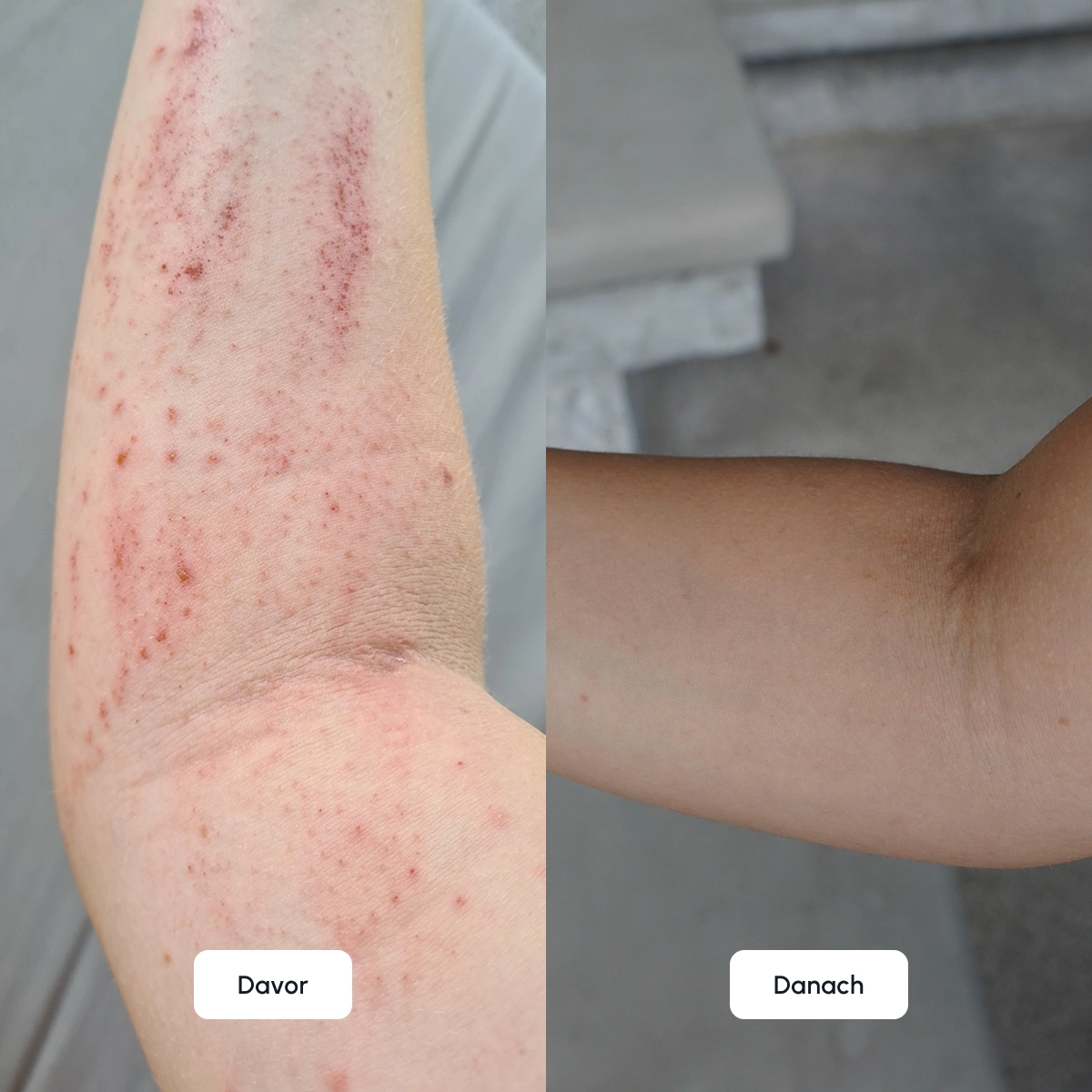 maria-k-before-after