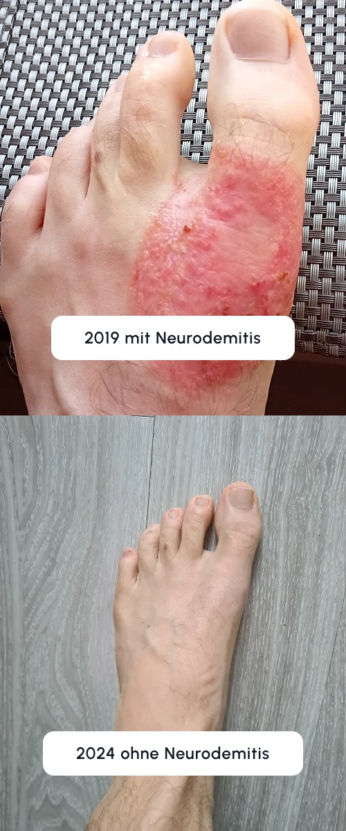 vincent-vorher-nachher